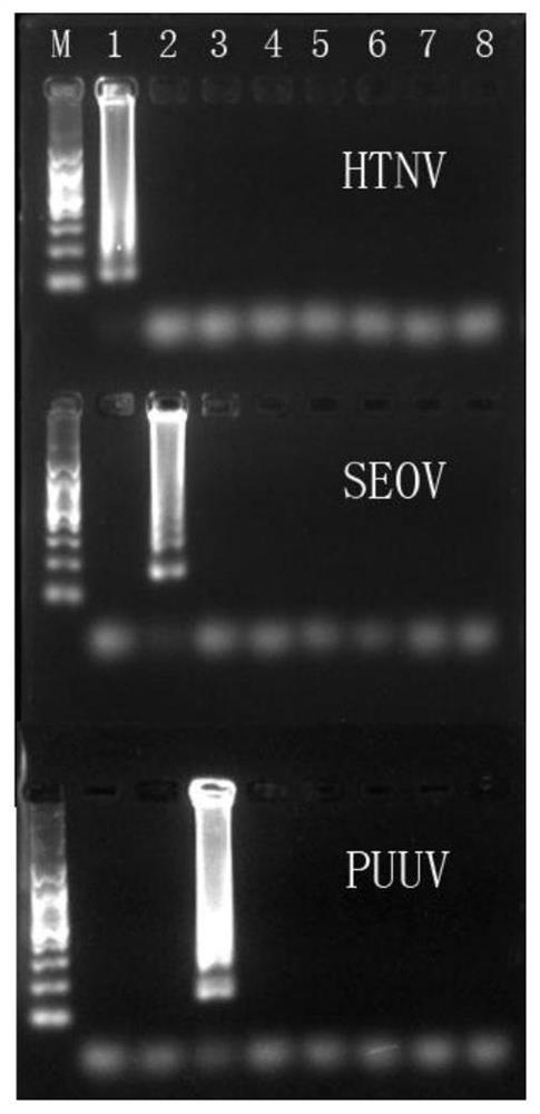 用于檢測漢坦病毒的檢測引物、檢測試劑盒及檢測方法