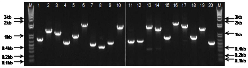 一種棘阿米巴特異性抗原肽、多克隆抗體及其用途
